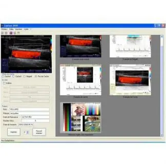 logiciel d'image echo-doppler couleur