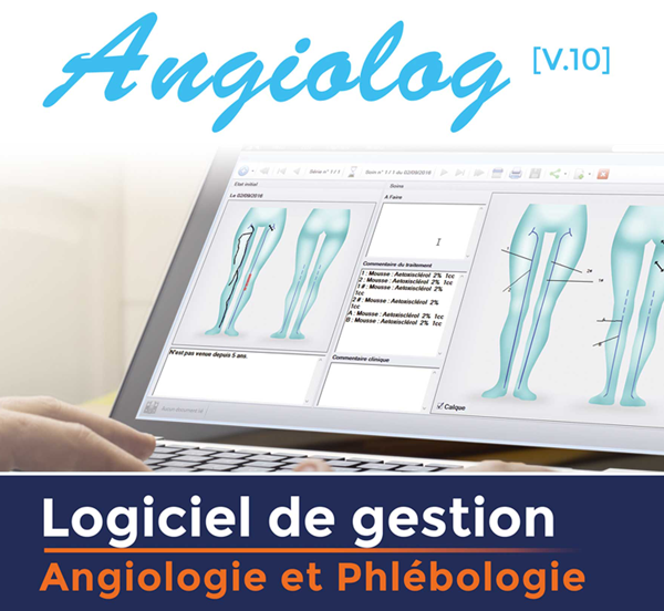 Angiolog-logiciel-medecine-