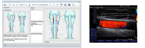 Logiciels médecine vasculaire